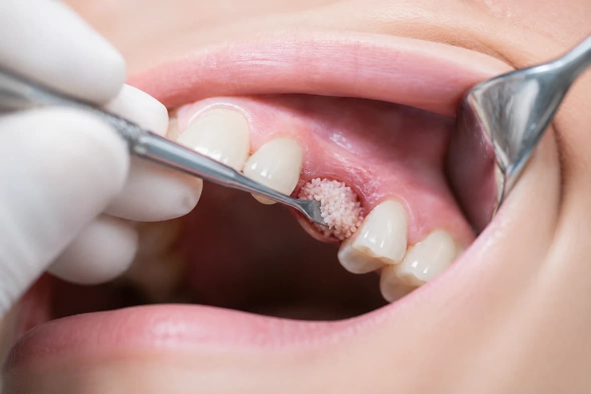 Oral surgery team at Peterborough Family Dental