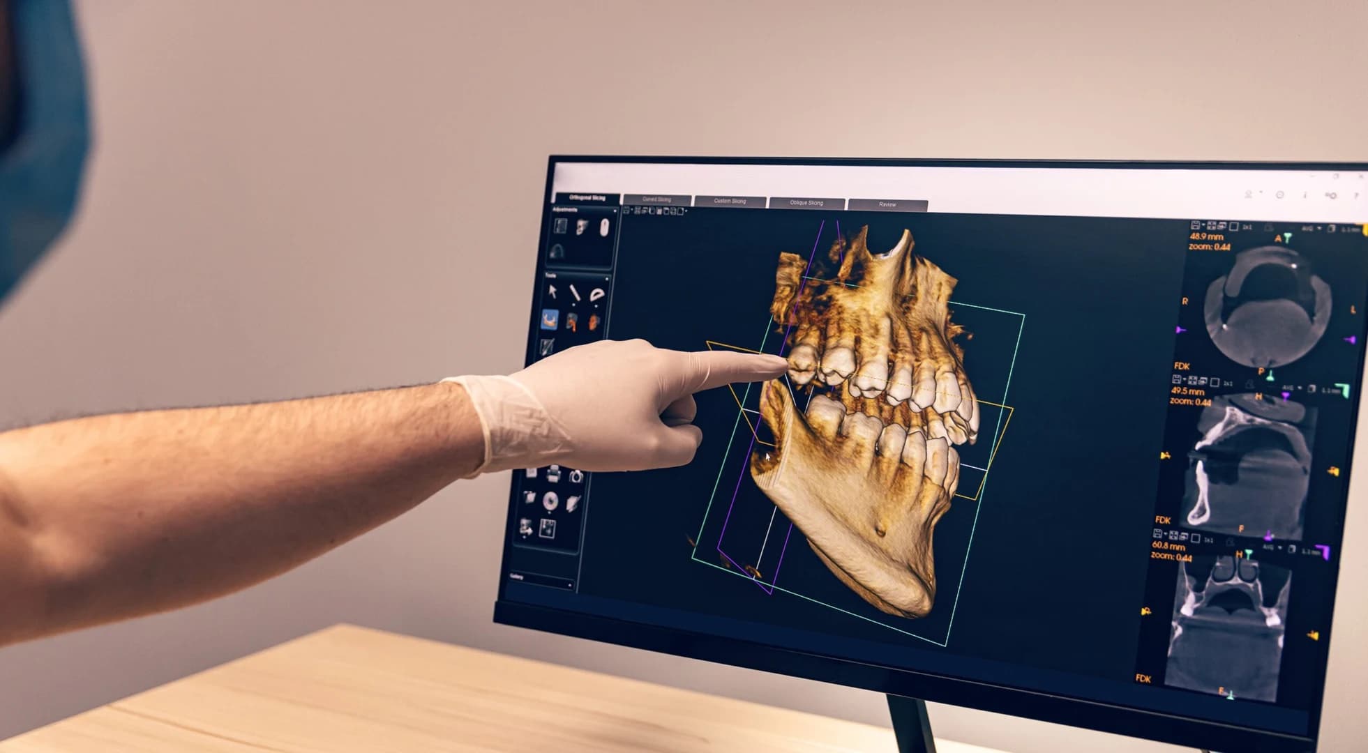 Free Consultation & 3D Scan