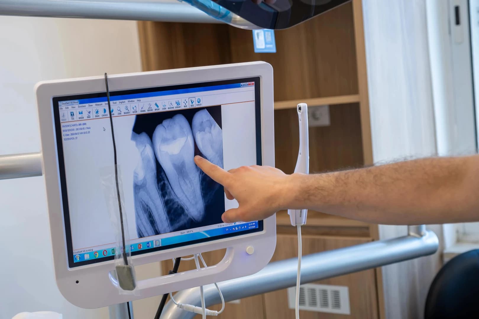 X-rays being reviewed before a root canal