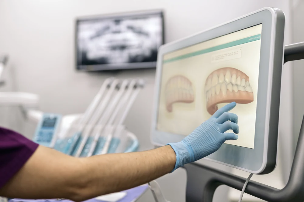 Our dentist reviewing a 3D model of a patient's teeth on the chairside screen
