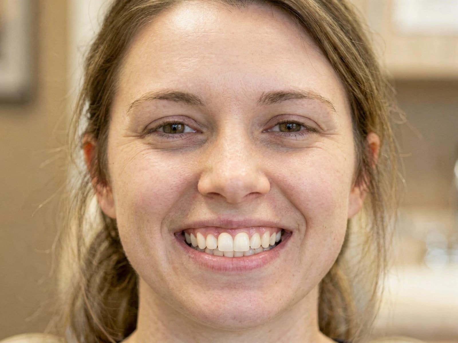 A front tooth, whole again, after treatment