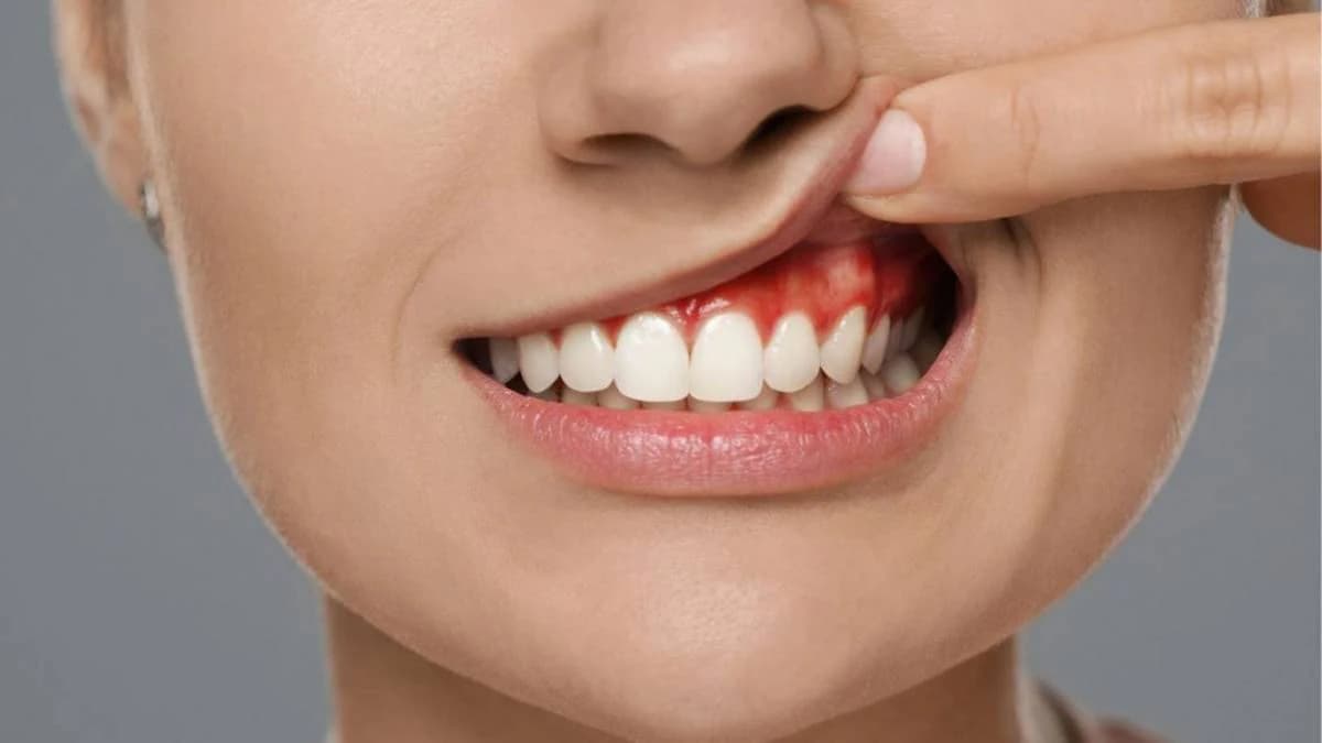Dental team treating a painful dental abscess