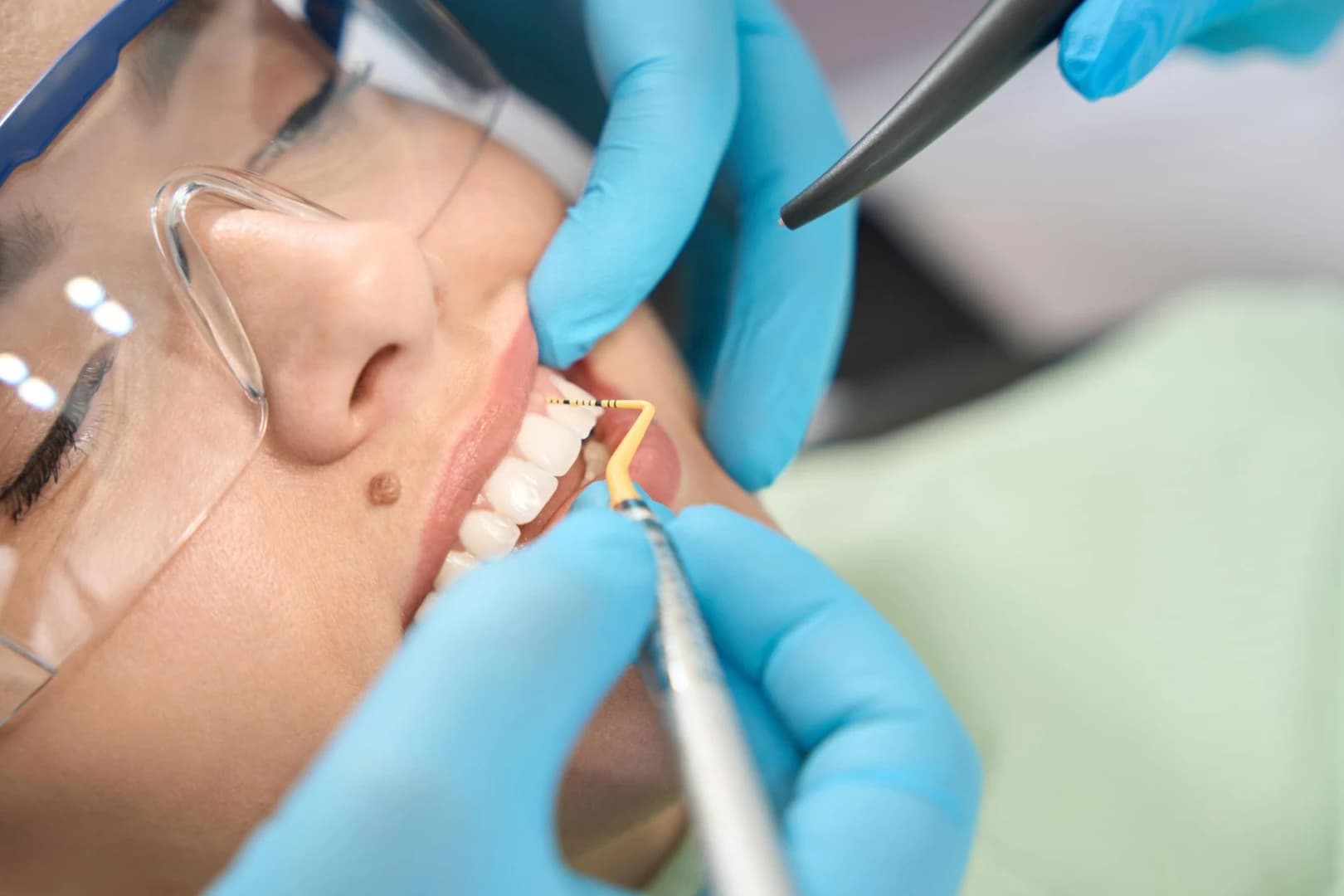 Comprehensive Periodontal Exam