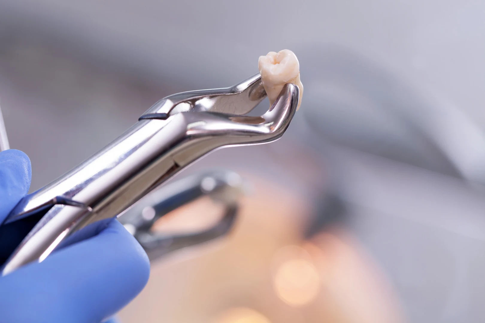 Oral surgery team for wisdom tooth removal