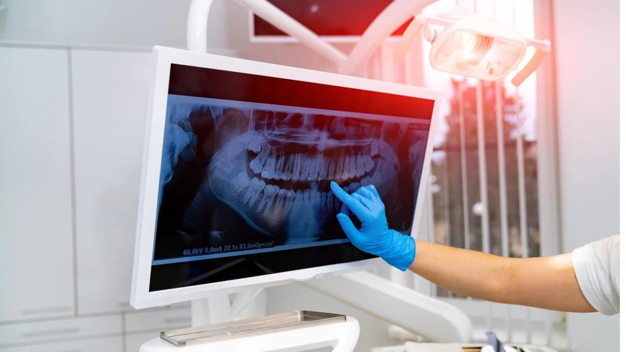 Exam and X-rays
