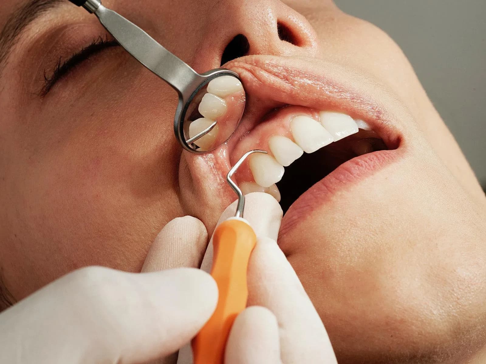 Dental hygienist performing a deep cleaning at Peterborough Family Dental