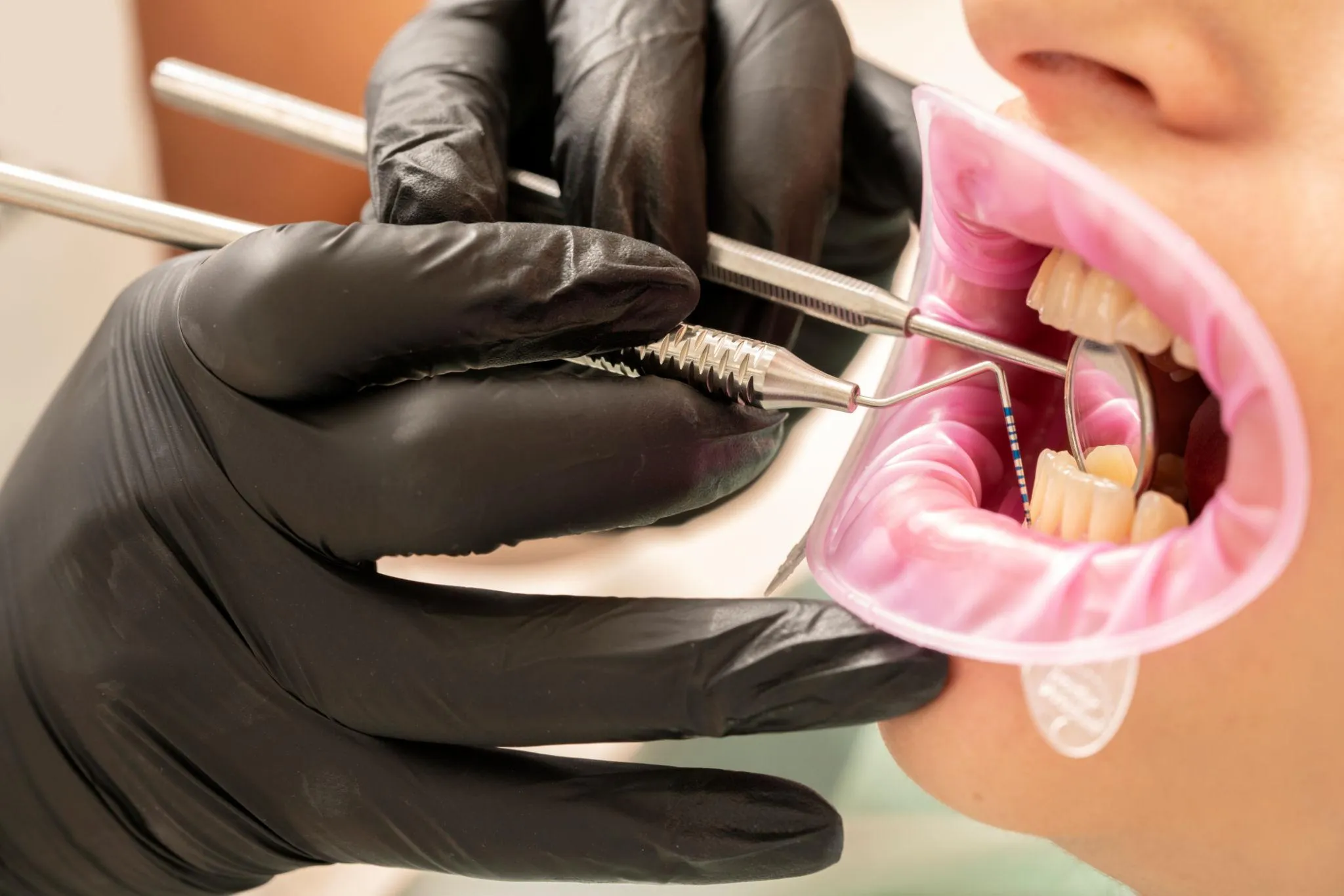 Comprehensive Periodontal Exam