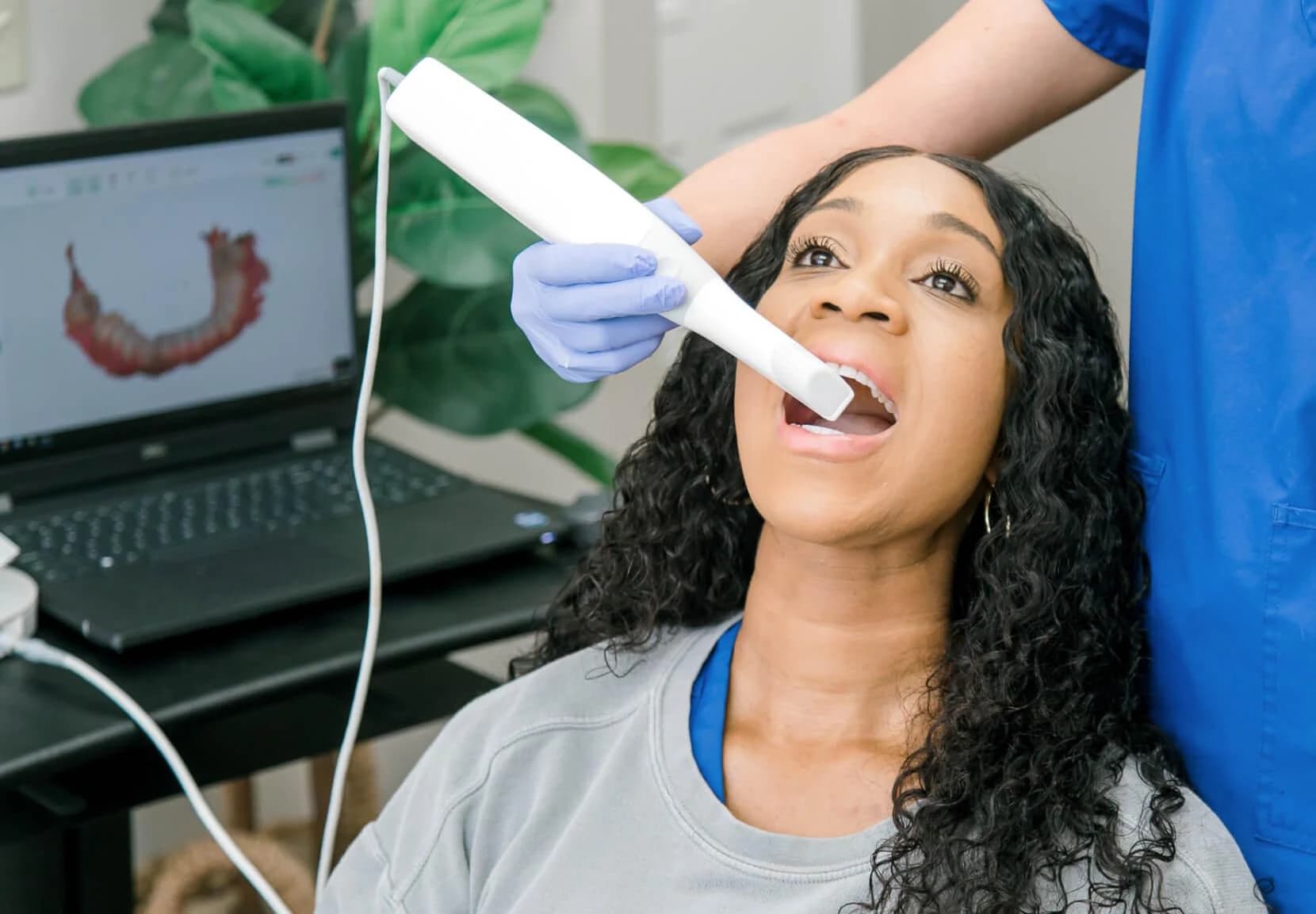 A handheld intraoral scanner capturing a 3D model of a patient's teeth