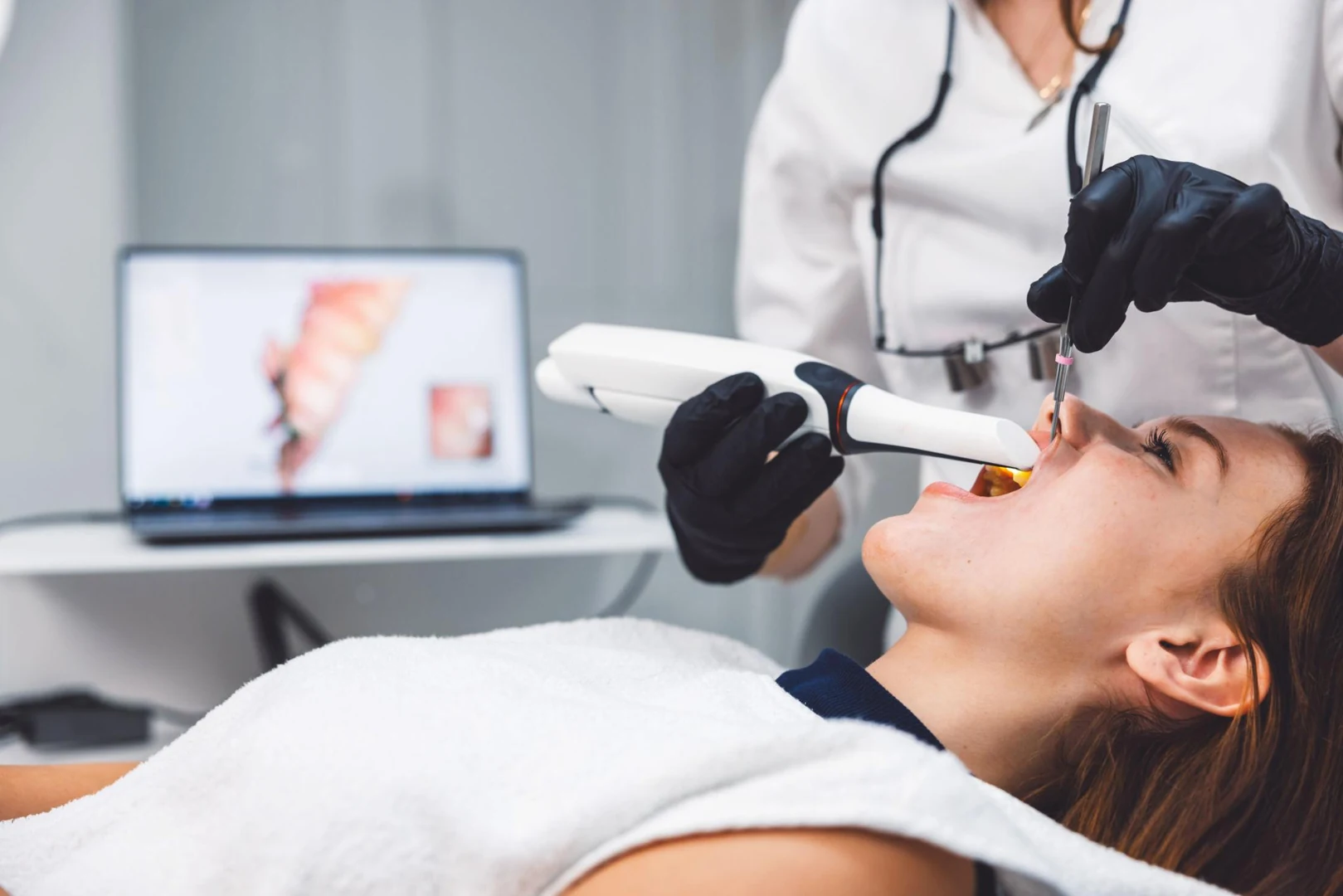 iTero digital intraoral scanner used for precise dental impressions
