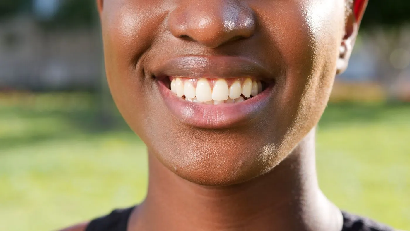 How dental bonding works